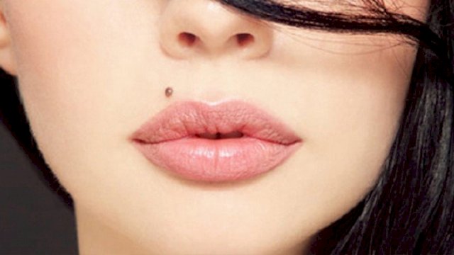 Ilustrasi tahi lalat di atas bibir.