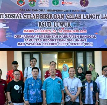 FKG Unhas adakan Operasi Bibir Sumbing Gratis di Luwuk Banggai