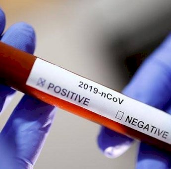 Dalam 1 Hari, Pasien Positif Virus Corona di Sulsel Bertambah 30 Orang