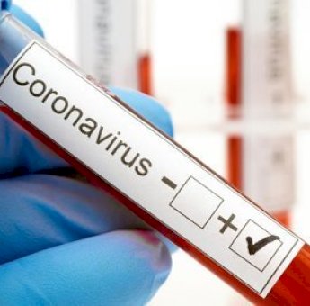 Raziah Rumah Bernyanyi di Soppeng, 5 Wanita Pemandu Karaoke Positif Covid-19