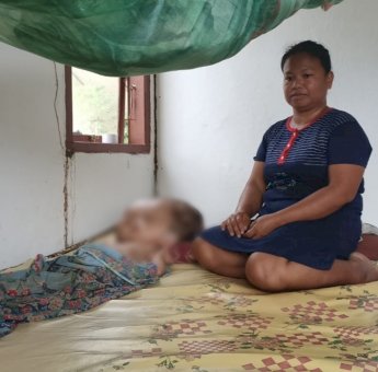 Kisah Seorang Ibu yang Berjuang Sendiri Merawat Anaknya Penderita Hidrocepalus