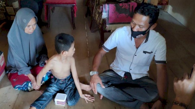 Kisah Suaebah Warga Sinjai yang Mengasuh Cucunya Terkena Lumpuh Kaku, Hingga Tak tersentuh Bantuan Pemerintah