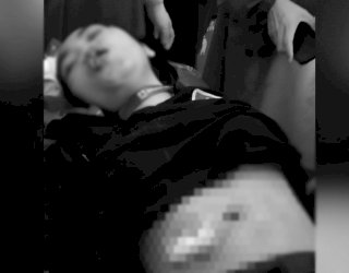 Karyawan Minimarket di Takalar Dibegal, Perut Ditusuk, Tas dan Dua HP Digondol Pelaku