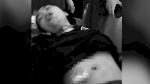 Kondisi Karyawan Minimarket saat baru saja tiba di RS Hadji Padjonga Daeng Ngalle Takalar, setelah menjadi korban Begal.