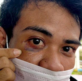 Cerita Warga Gowa Nyaris Buta Akibat Diserang Geng Motor Gunakan Celurit dan Busur