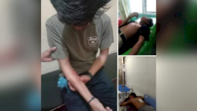 Postingan akun Facebook bernama Anhye memperlihatkan 3 remaja terkena busur di wilayah Galesong Utara, Kabupaten Takalar, Sulawesi Selatan, Jumat (28/01/2022) malam.