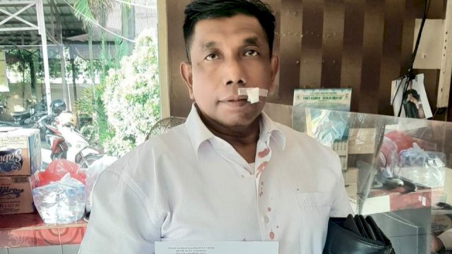 Sugeng, Pengurus KONI Kaltim yang terkena Pukulan dan melaporkan pemukulan ke Pihak berwajib.