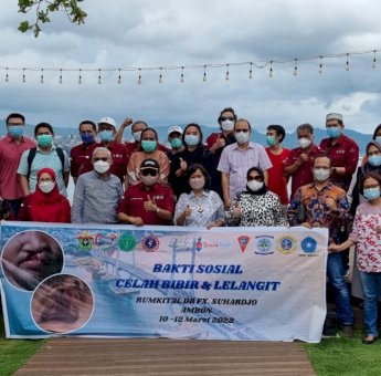 FKG Unhas Gelar Operasi Gratis Celah Bibir dan Lelangit di Kota Ambon