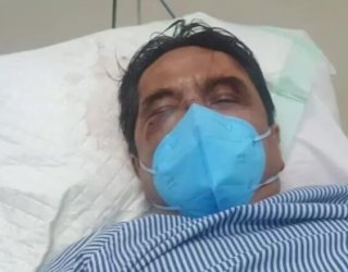 Ade Armando Alami Pendarahan Hidung dan Kandung Kemih Akibat Pengeroyokan Demo 11 April