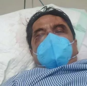 Ade Armando Alami Pendarahan Hidung dan Kandung Kemih Akibat Pengeroyokan Demo 11 April