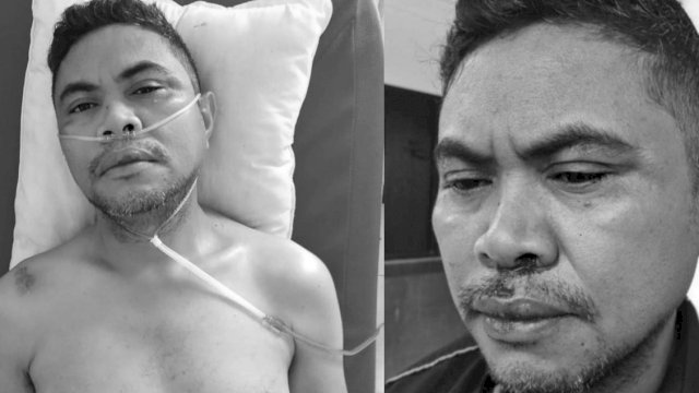 Inilah kondisi Febianus Latuan usai dianiaya oleh orang&nbsp; yang tak dikenal. (Istimewa)