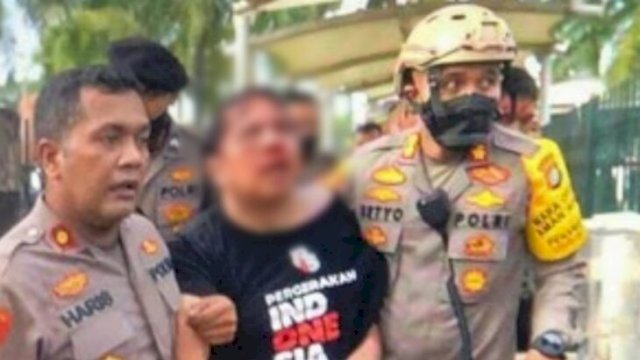 Ade Armando Terlihat Babak-belur Usai Mengikuti Demonstrasi 11 April 2022. (Istimewa)