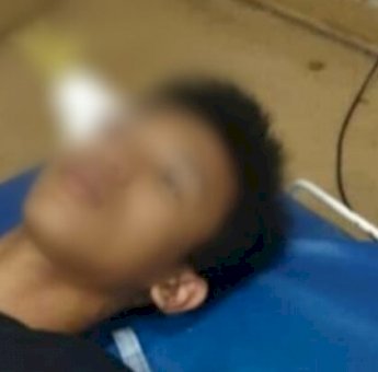 Tak Miliki Biaya Operasi, Korban Pembusuran di Gowa Hanya Bisa Terbaring Lemas Dengan Anak Panah Tertancap di Dahi