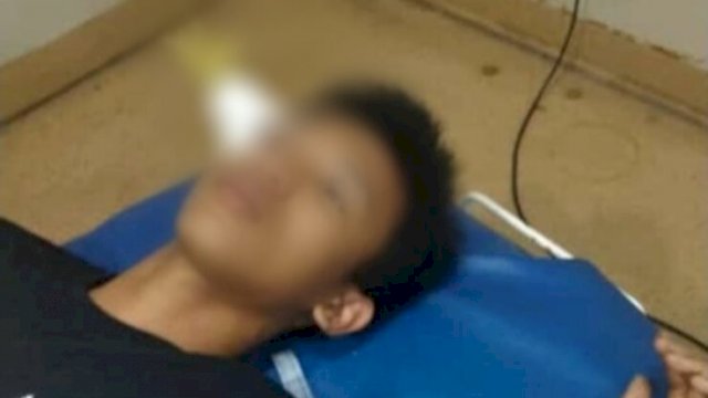 Muhammad Putra (14) warga Kabupaten Gowa hanya bisa terbaring lemas dengan anak panah tertancap di dahinya, di salah satu rumah sakit karena tak memiliki biaya operasi. Ia tak mendapatkan pertolongan medis setelah dua hari menjadi korban pembusuran pada malam Takbir, Minggu (01/05/2022) malam lalu. (Al-Ghifari)