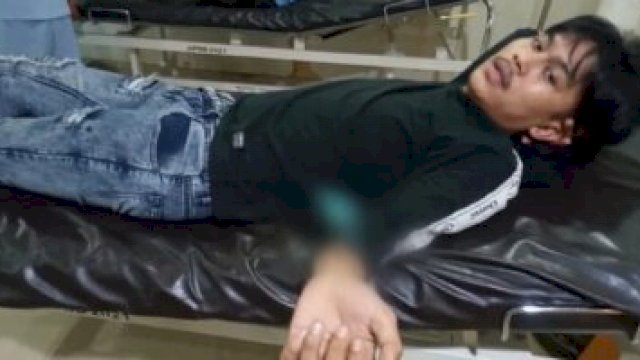Farhan, korban pembusuran oleh sekelompok Geng Motor terbaring di RS Labuangbaji Makassar, dengan busur masih tertancap di tangannya. (Istimewa)