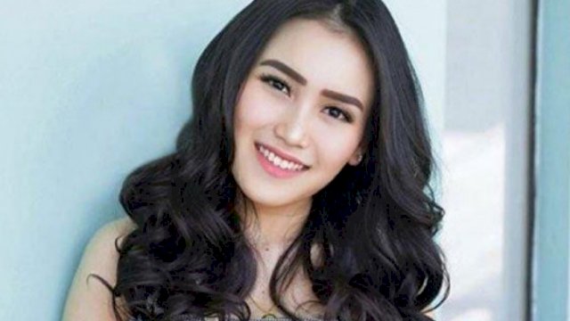 Penyanyi Ayu Ting Ting. Foto:ist