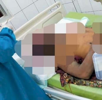 Adik Aniaya Kakak Kandung di Kotawaringin Timur