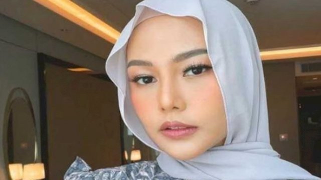 Selebgram Dara Arafah. (Foto: Istimewa)